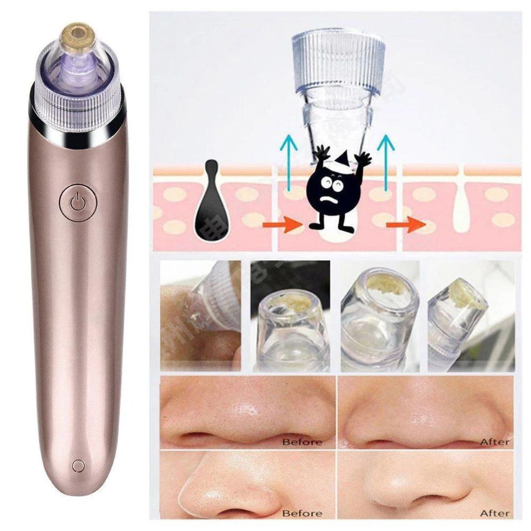 Aparat de Curățare Facială cu Vacuum pentru Puncte Negre, cu 3 Capete și Încărcare USB
