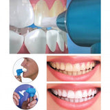 Aparat pentru Albirea și Lustruirea Dinților Luma Smile, 14.000 RPM, cu 5 Capete Incluse